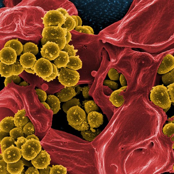 Extremely tough bacteria's resistance under the microscope