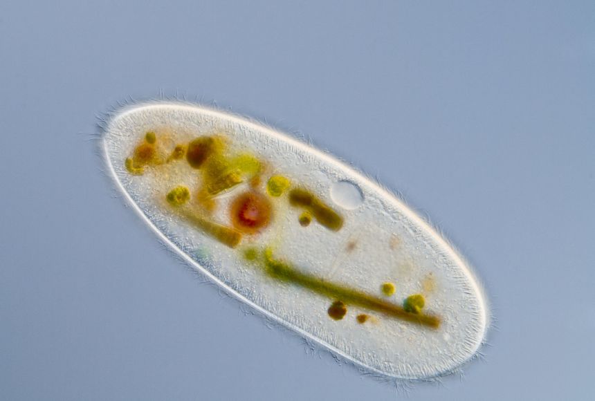 There are many types of unicellular organisms in the world, including protists like this one, which feed mainly on diatoms, amoebas, bacteria, and algae.