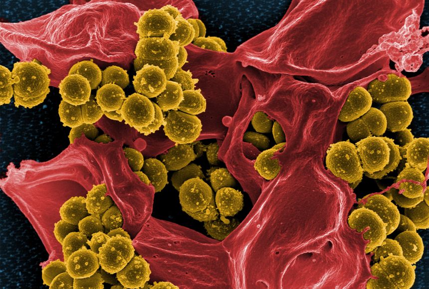 As humans continue to use antibiotics to fight bacterial infections, bacteria are evolving to fight back, like these methicillin-resistant Staphylococcus aureus bacteria (yellow), which have evolved a resistance to antibiotics and are seen here fighting w