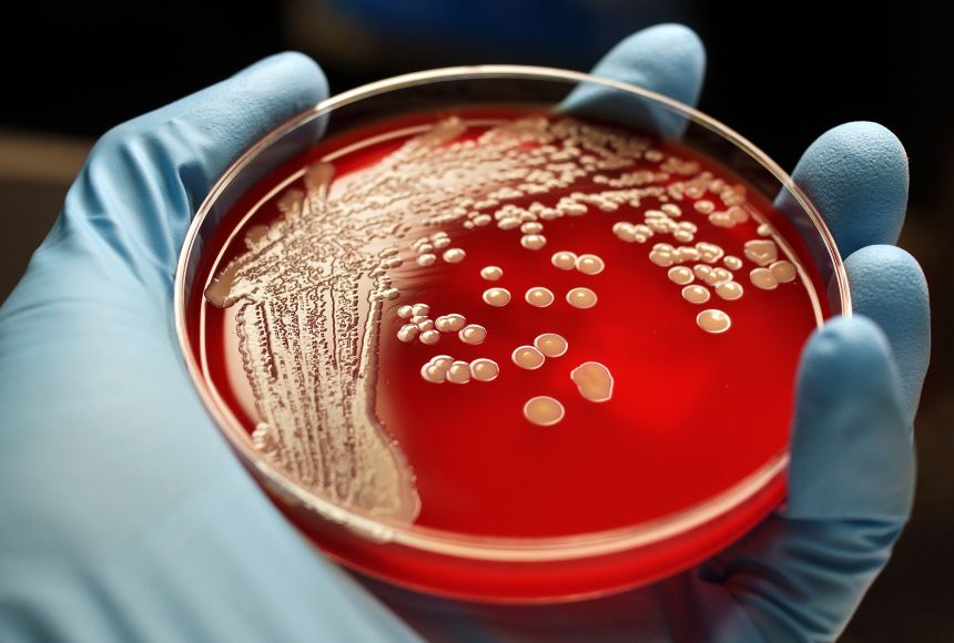 Staphylococcus, Description, Characteristics, Diseases, & Antibiotic  Resistance