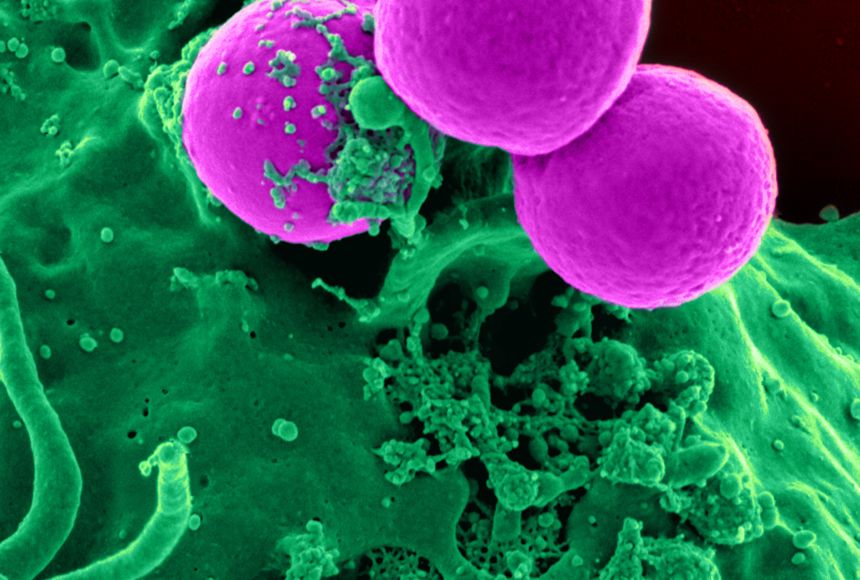 This electron micrograph depicts a human neutrophil ingesting methicillin resistant Staphylococcus aureus, or MRSA.