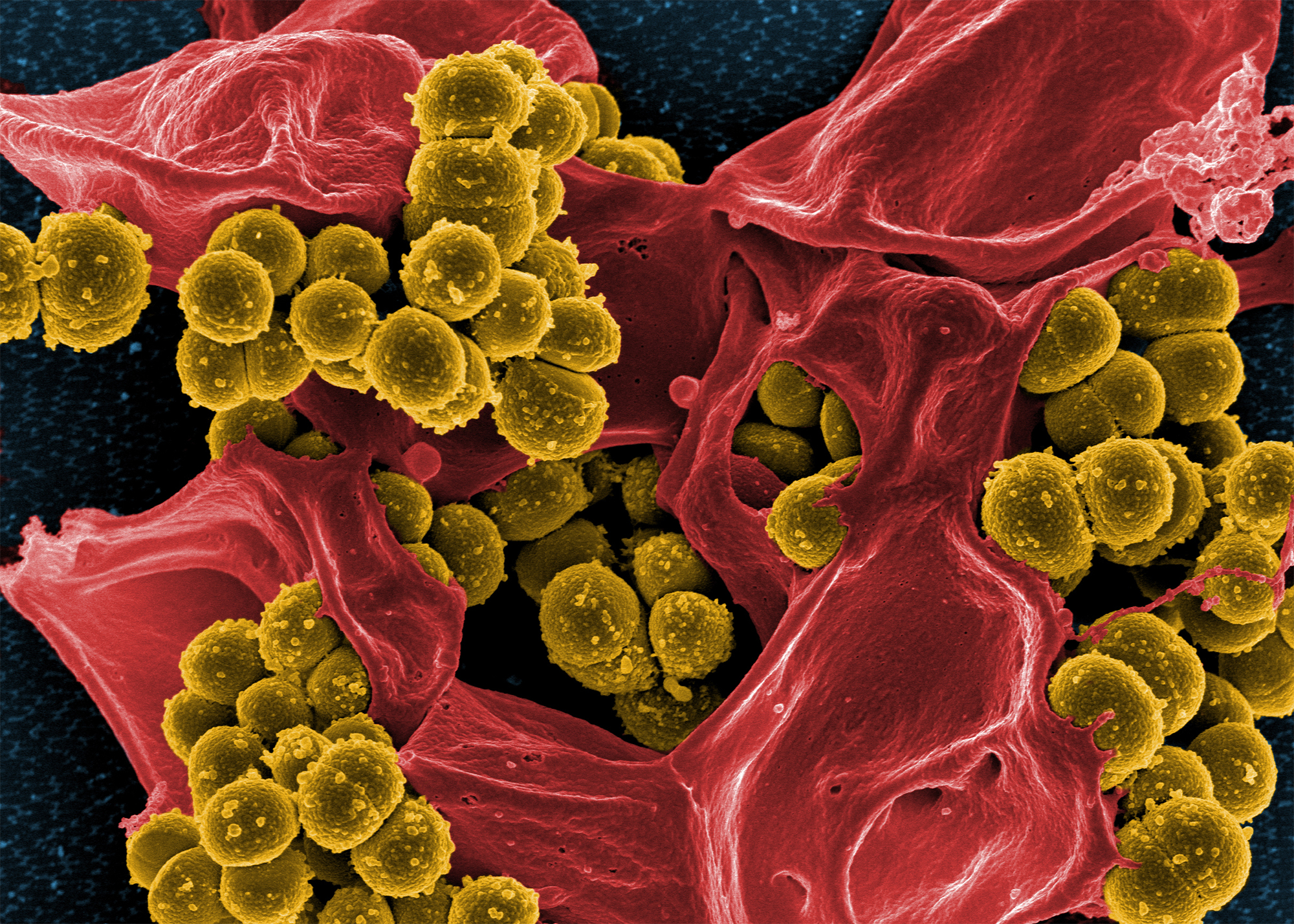 Extremely tough bacteria's resistance under the microscope